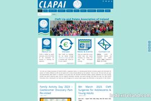 Visit Cleft Lip and Palate Association of Ireland website.